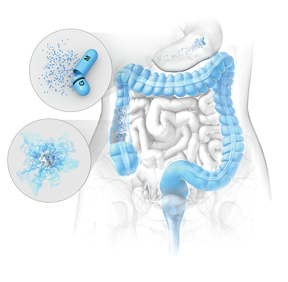 A photo of human colon with granules depicts how APRISO’s INTELLICOR® delayed- and extended-release delivery works.